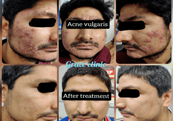 grace clinic dehradun
