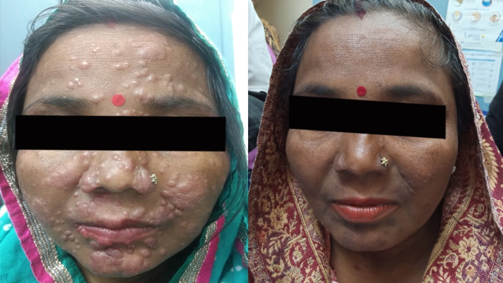 Before & After (ENL)